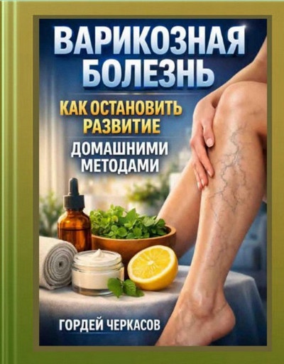 Гордей Черкасов | Варикозная болезнь. Как остановить развитие домашними методами (2026) [PDF]